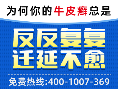 牛皮癣如何在干燥天气下维持健康肌肤