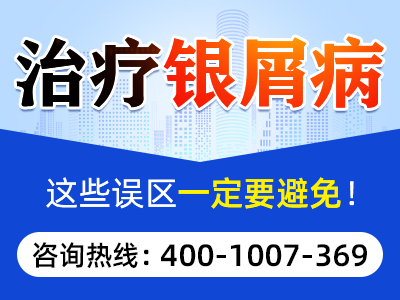 阴雨天银屑病患者的护理策略和生活建议